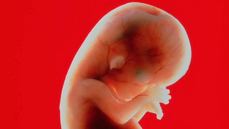 Foetus at 11 weeks